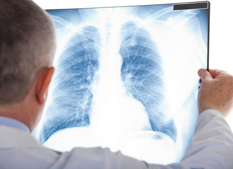 corsi ecm per fisioterapisti linfodrenaggio la diagnostica per immagini in riabilitazione