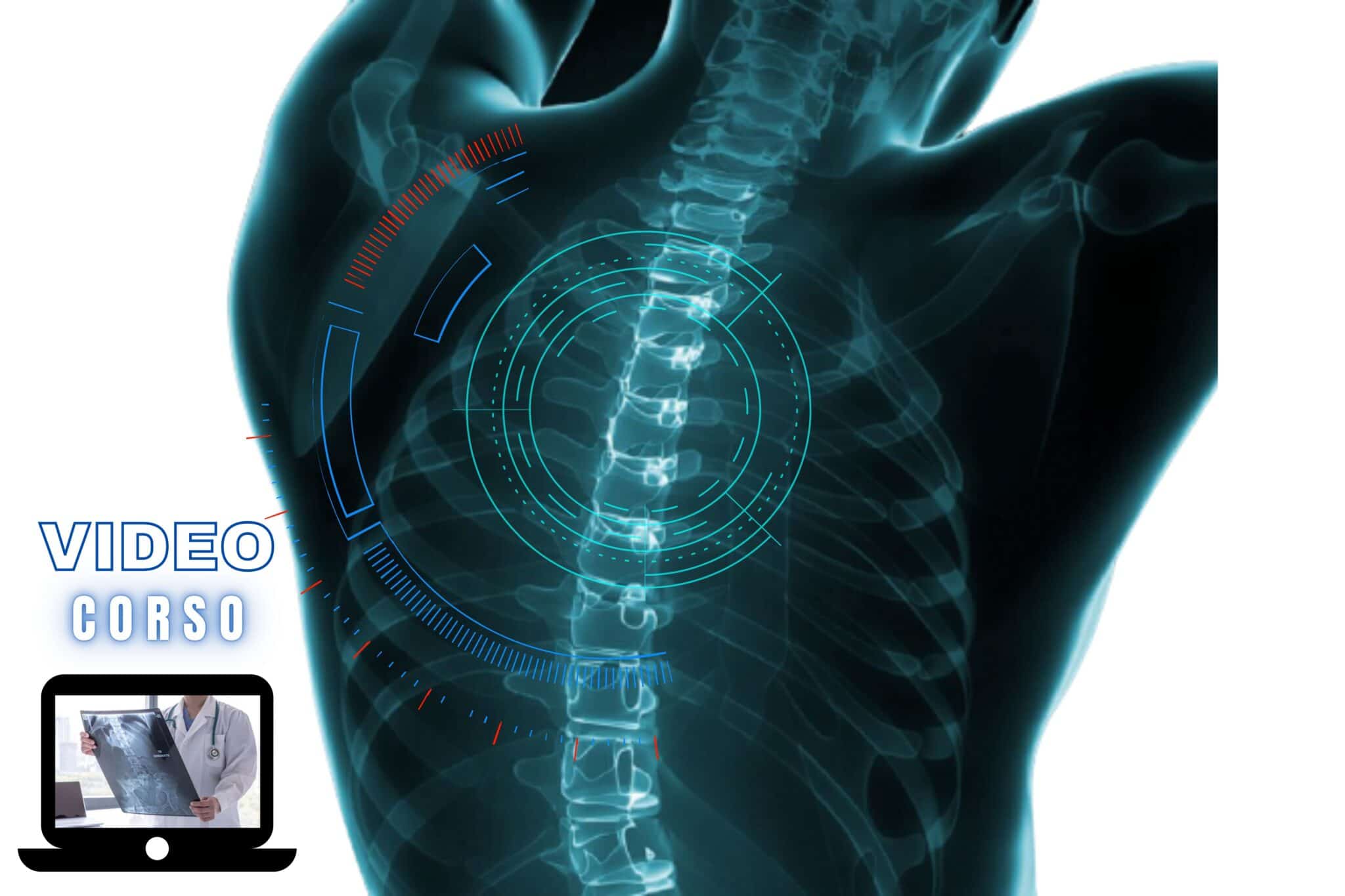l'imaging del rachide dal sospetto clinico alla diagnosi