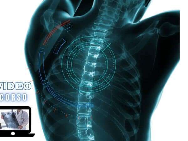 l'imaging del rachide dal sospetto clinico alla diagnosi