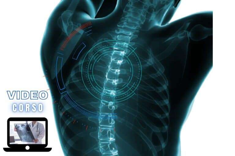 l'imaging del rachide dal sospetto clinico alla diagnosi
