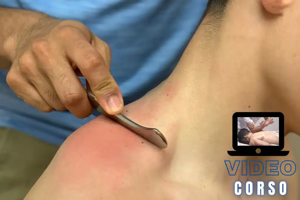 Terapia Manuale miofasciale Integrata