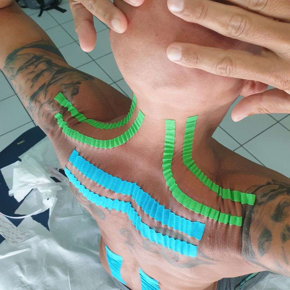 taping-neuromuscolare-corso-ecm-per-fisioterapisti-3