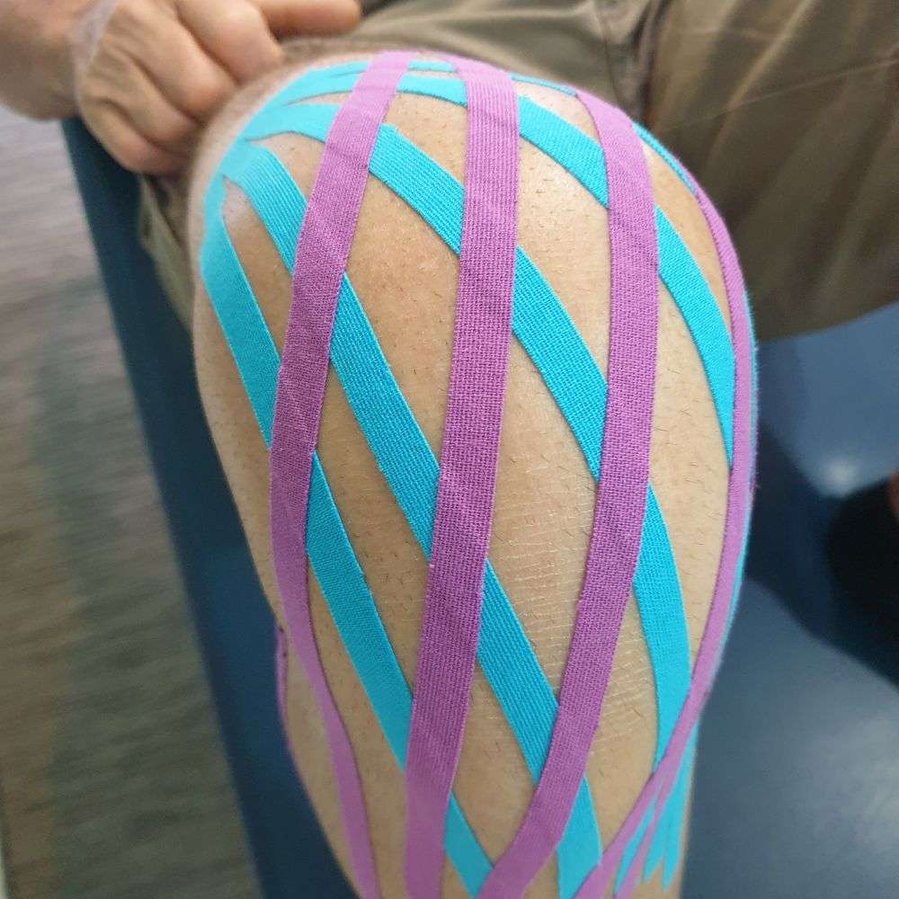 taping neuromuscolare