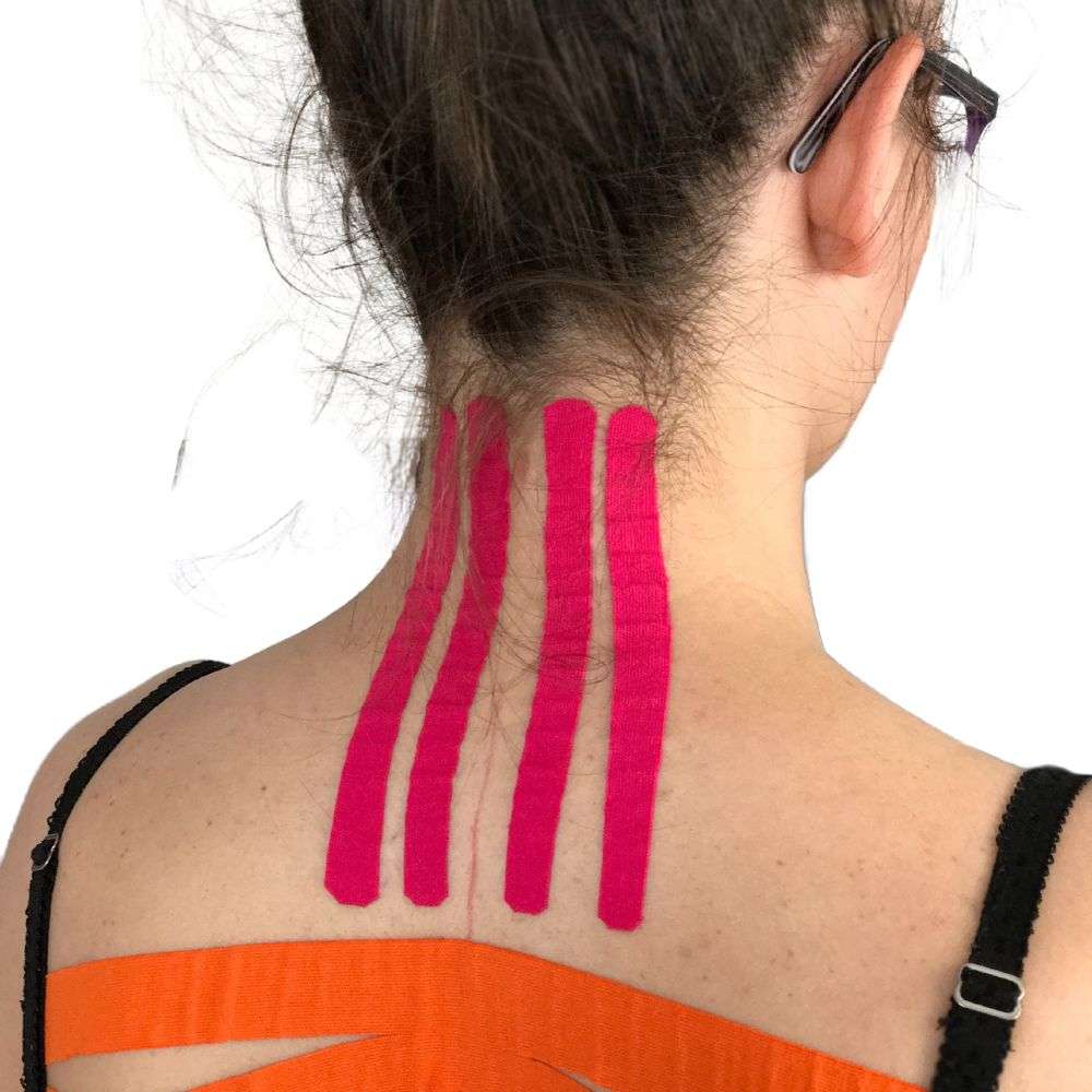 taping-neuromuscolare-corso-ecm-per-fisioterapisti-6