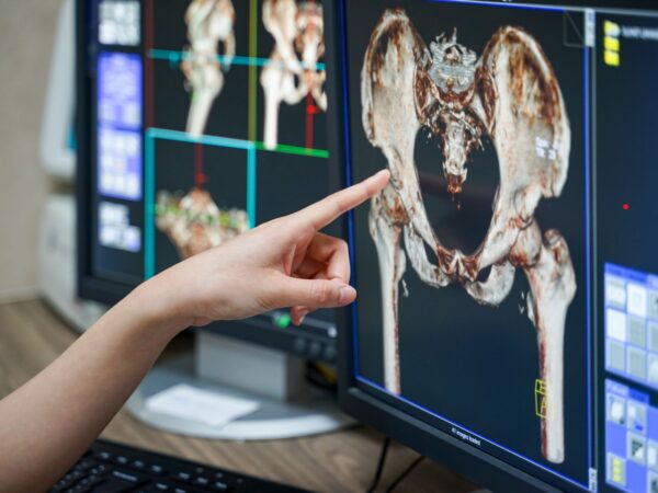 Imaging Radiologico in fisioterapia