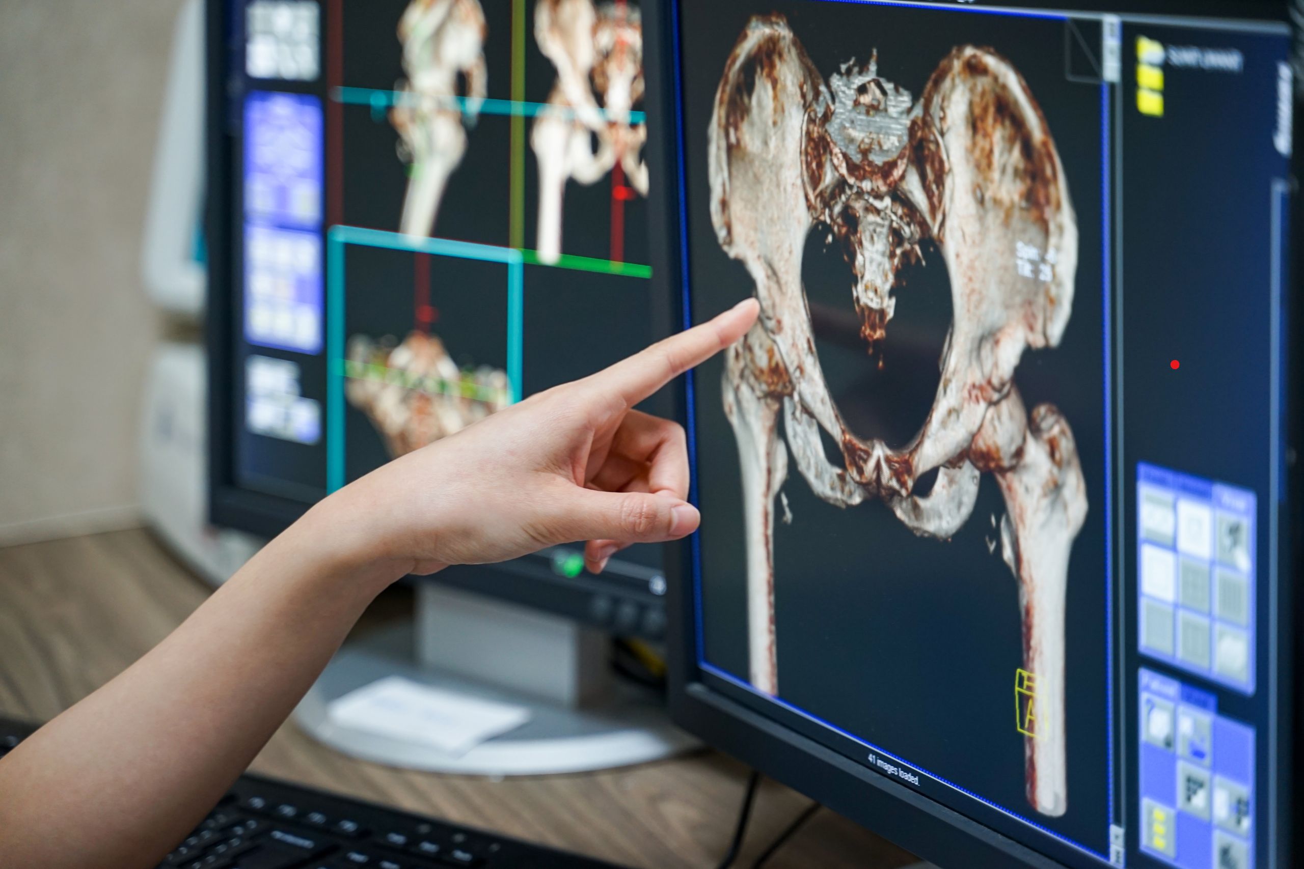 imaging radiologico in fisioterapia